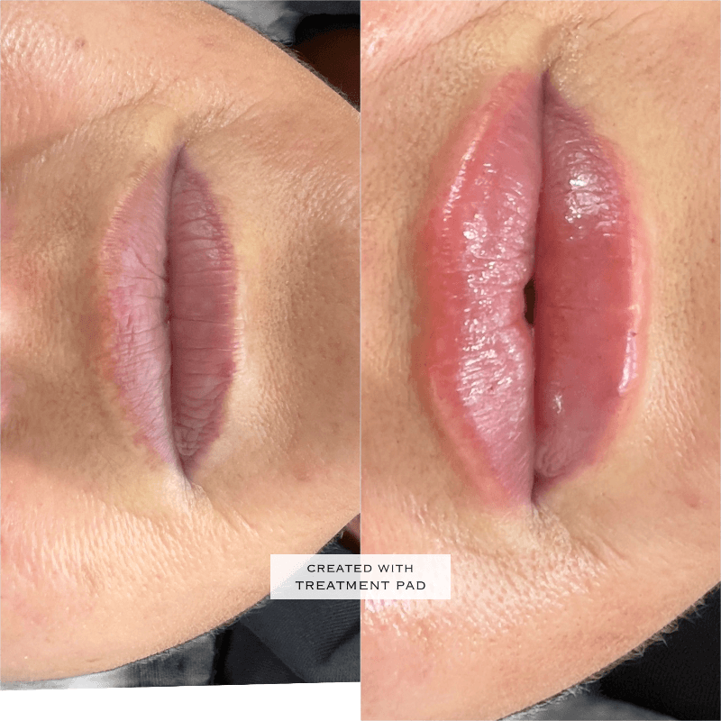 reTouch Restore Regenerate Refine in Lisburn