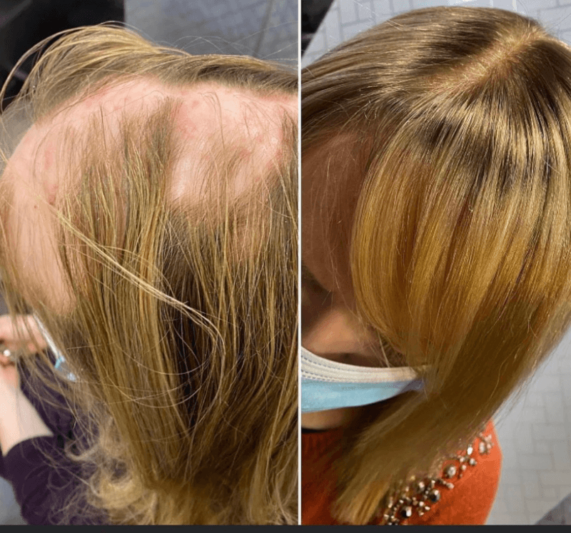 The Hair Initiative in Bangor